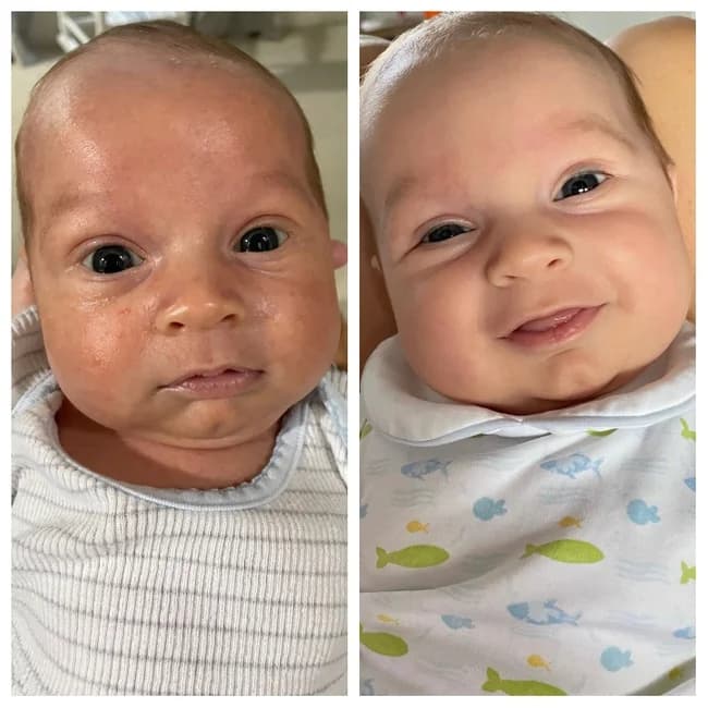 Baby Skincare — Before/After Comparison
