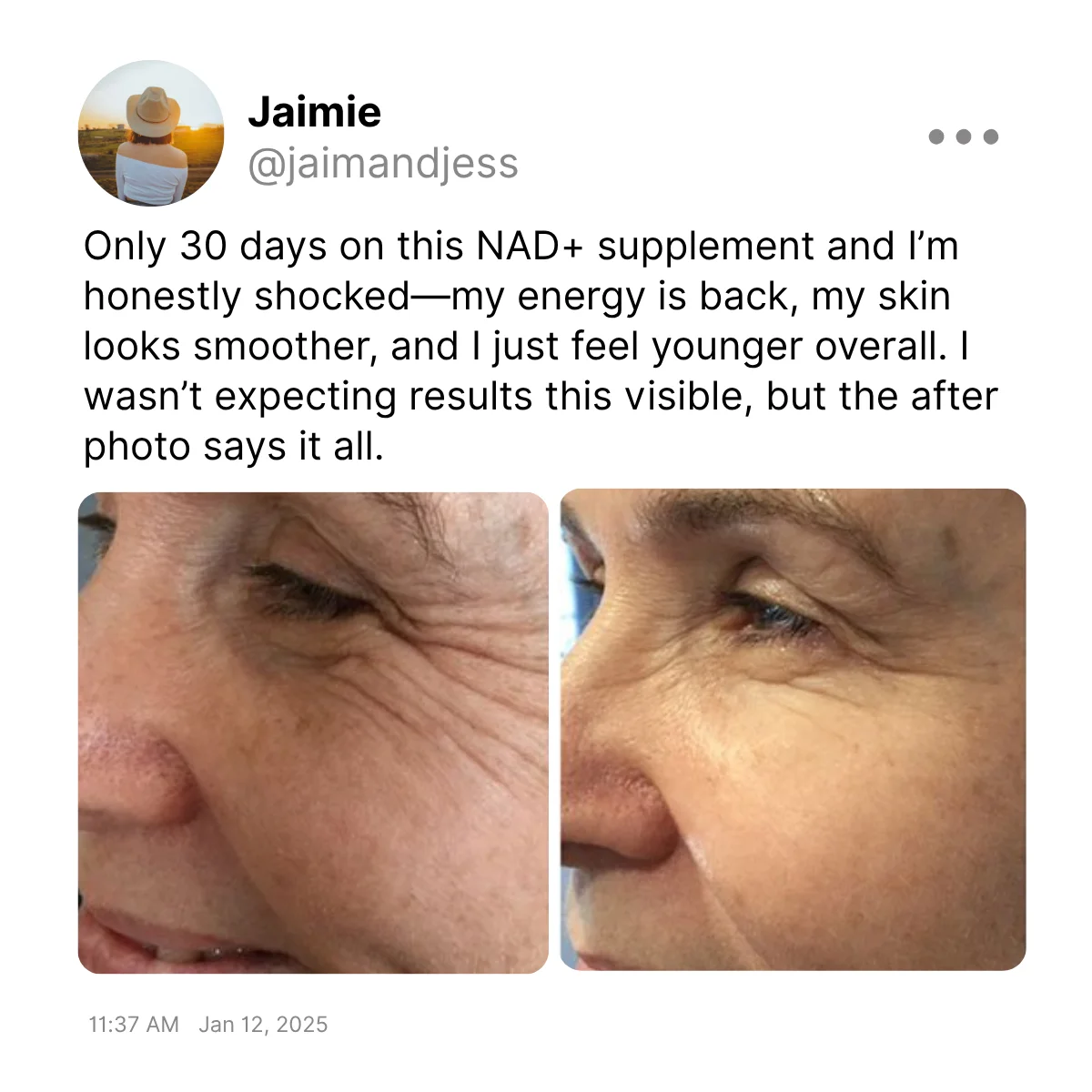 NAD+ Supplement — Before/After Testimonial