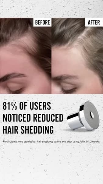 Jolie Hair Shedding — Before/After Comparison