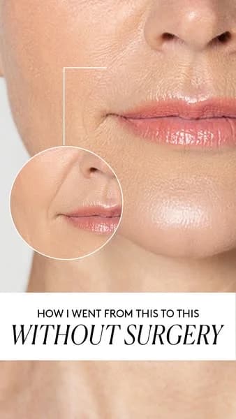 Cocunat Anti-Aging — Before/After Zoom