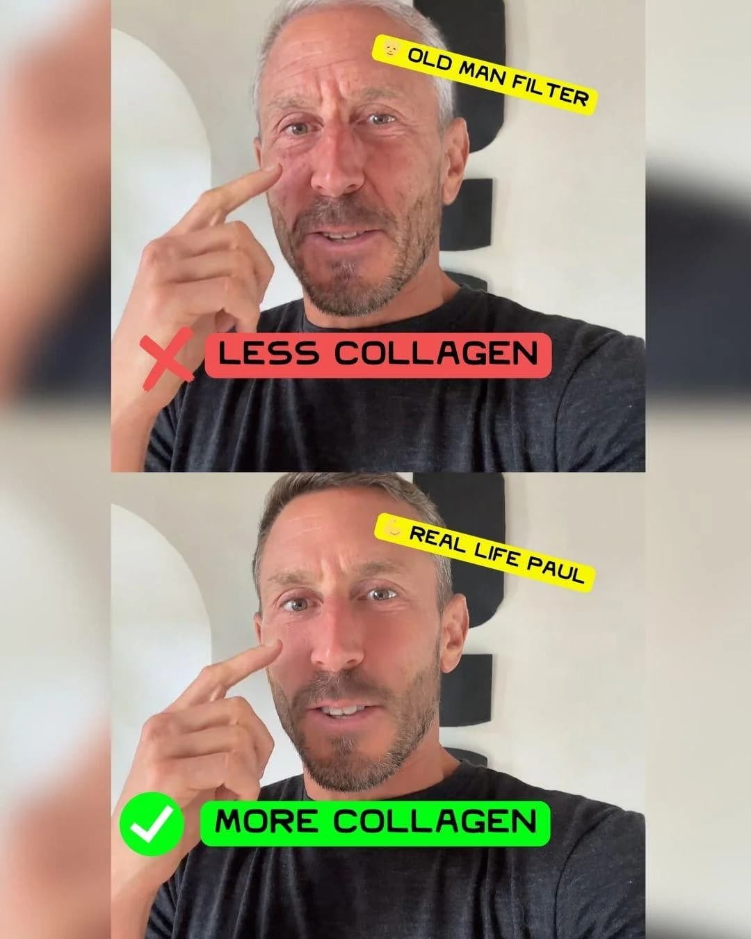 Lineage Provisions — Before/After Filter Comparison