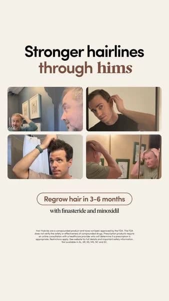 Hims Hair Regrowth — Before/After Grid