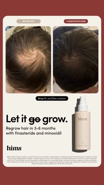 Hims Hair Regrowth — Before/After & Product