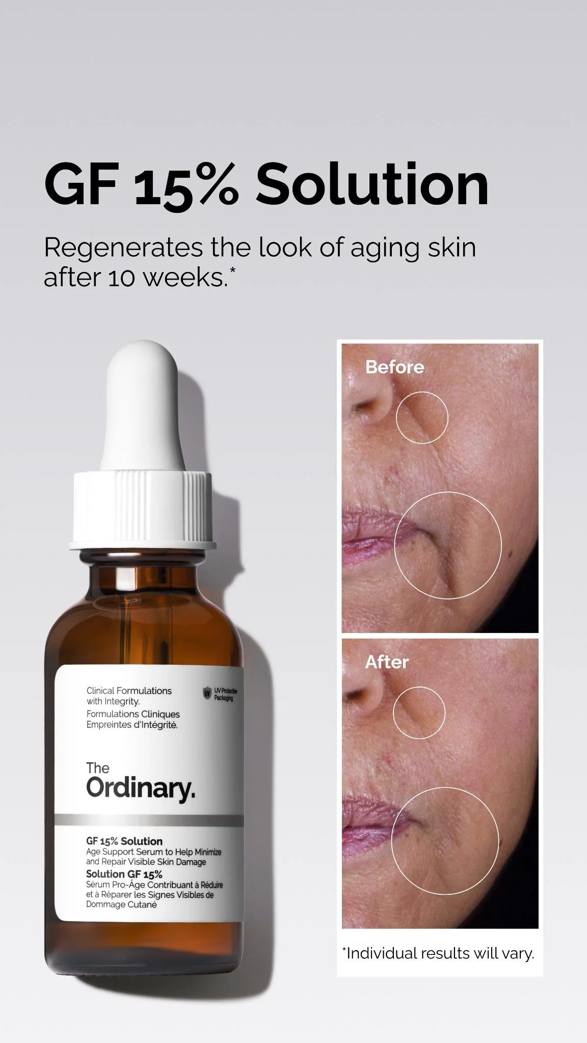 The Ordinary GF 15% Solution before-and-after static ad on a clean white background